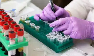 Comprendre les différents types de tests ADN pour mieux choisir celui qui convient à vos besoins de santé