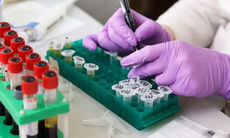 Comprendre les différents types de tests ADN pour mieux choisir celui qui convient à vos besoins de santé
