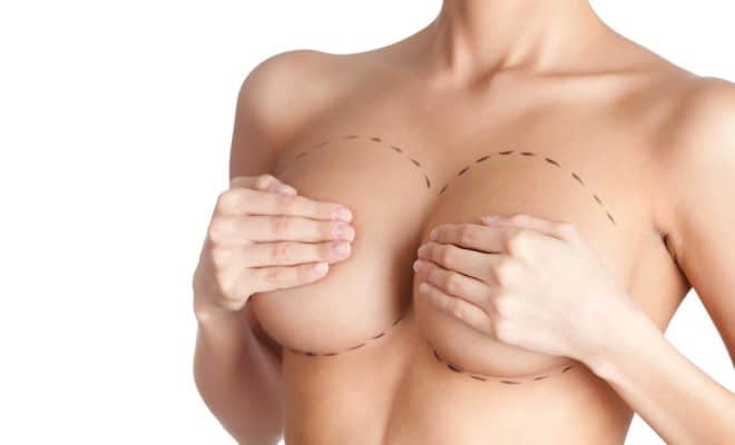 lipofilling mammaire